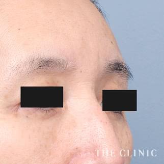 【THE CLINIC 症例画像】No.1421_2