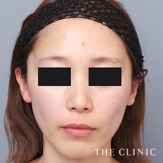 【THE CLINIC 症例画像】No.1432_1