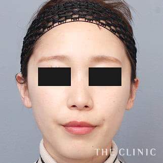 【THE CLINIC 症例画像】No.1432_2