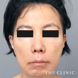 【THE CLINIC 症例画像】No.1433_1