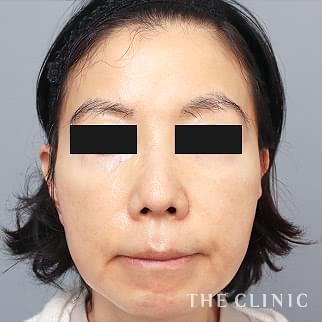 【THE CLINIC 症例画像】No.1433_2