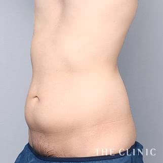 【THE CLINIC 症例画像】No.1434_1