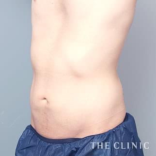 【THE CLINIC 症例画像】No.1434_2