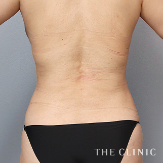 【THE CLINIC 症例画像】No.1436_2