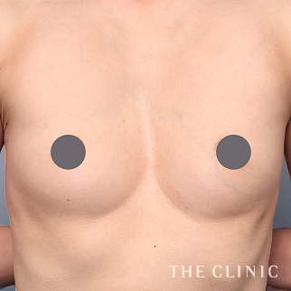 【THE CLINIC 症例画像】No.1448_1