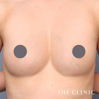 【THE CLINIC 症例画像】No.1448_2