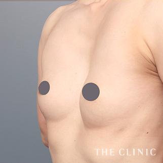 【THE CLINIC 症例画像】No.1449_1