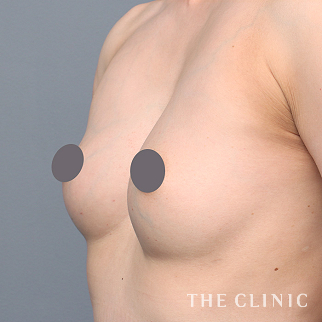 【THE CLINIC 症例画像】No.1449_2