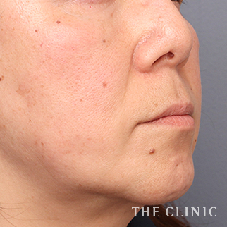 【THE CLINIC 症例画像】No.1454_1