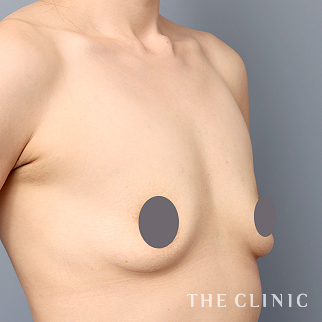 【THE CLINIC 症例画像】No.1475_1