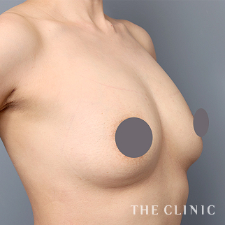 【THE CLINIC 症例画像】No.1475_2