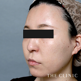 【THE CLINIC 症例画像】No.1476_2