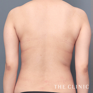 【THE CLINIC 症例画像】No.1482_1