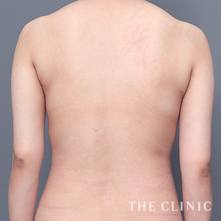 【THE CLINIC 症例画像】No.1482_2