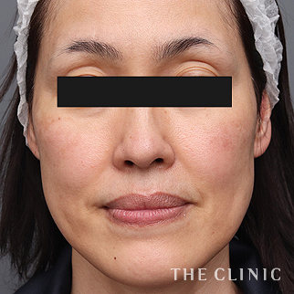 【THE CLINIC 症例画像】No.1484_1