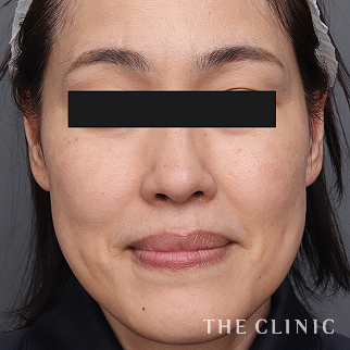 【THE CLINIC 症例画像】No.1484_2