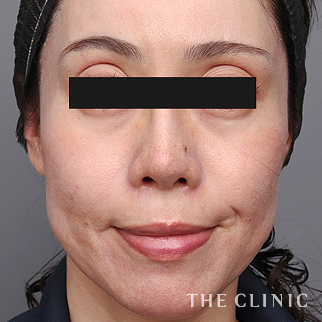 【THE CLINIC 症例画像】No.1497_1