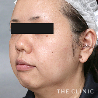 【THE CLINIC 症例画像】No.1505_1