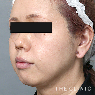 【THE CLINIC 症例画像】No.1505_2