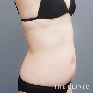 【THE CLINIC 症例画像】No.1509_1