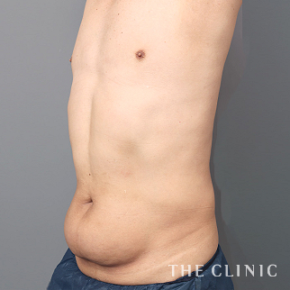 【THE CLINIC 症例画像】No.1511_1