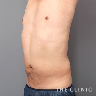 【THE CLINIC 症例画像】No.1511_2