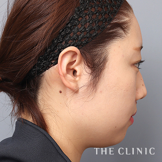 【THE CLINIC 症例画像】No.1520_1