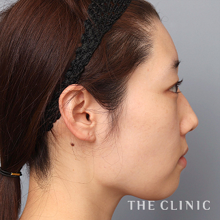 【THE CLINIC 症例画像】No.1520_2