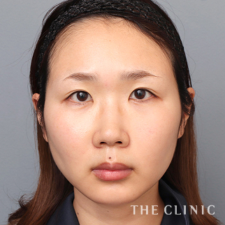 【THE CLINIC 症例画像】No.1521_1