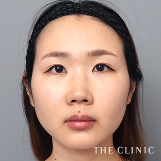 【THE CLINIC 症例画像】No.1521_2