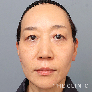 【THE CLINIC 症例画像】No.1522_1