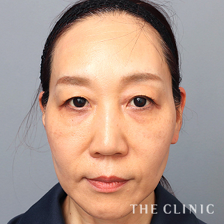 【THE CLINIC 症例画像】No.1522_2