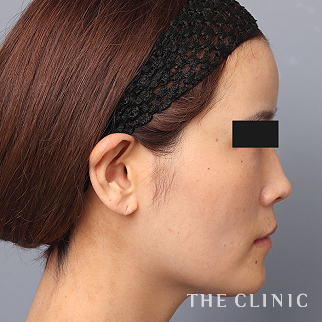 【THE CLINIC 症例画像】No.1523_2