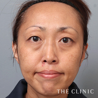 【THE CLINIC 症例画像】No.1524_1