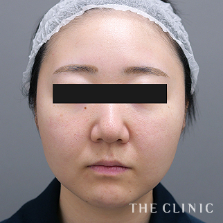 【THE CLINIC 症例画像】No.1526_1