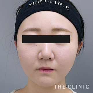 【THE CLINIC 症例画像】No.1526_2