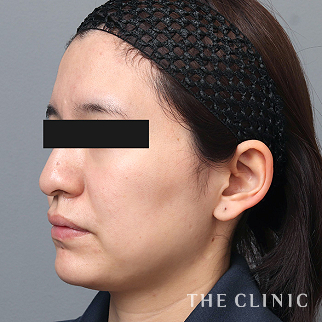 【THE CLINIC 症例画像】No.1532_1