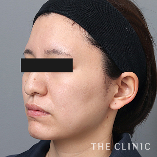 【THE CLINIC 症例画像】No.1532_2