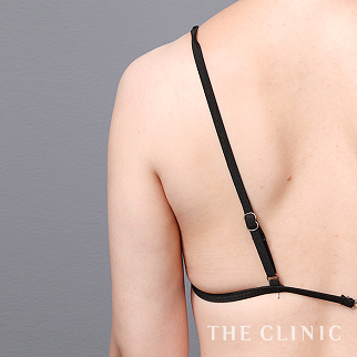 【THE CLINIC 症例画像】No.1541_2_二の腕_ベイザー脂肪吸引