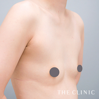 【THE CLINIC 症例画像】No.1550_1