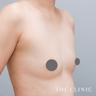 【THE CLINIC 症例画像】No.1550_2