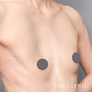 【THE CLINIC 症例画像】No.1588_1