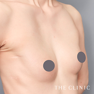 【THE CLINIC 症例画像】No.1588_2