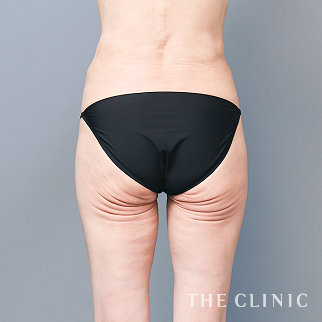 【THE CLINIC 症例画像】No.1592_1