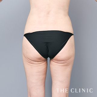 【THE CLINIC 症例画像】No.1592_2