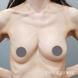 【THE CLINIC 症例画像】No.1603_1