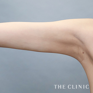 【THE CLINIC 症例画像】No.1605_2