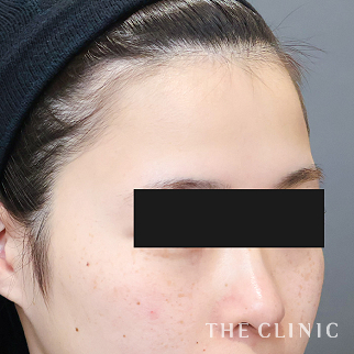 【THE CLINIC 症例画像】No.1607_1