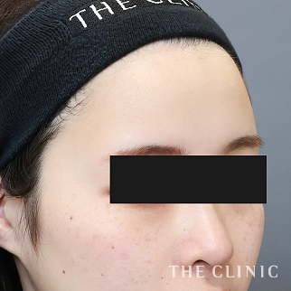 【THE CLINIC 症例画像】No.1607_2