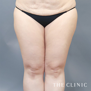 【THE CLINIC 症例画像】No.1608_1